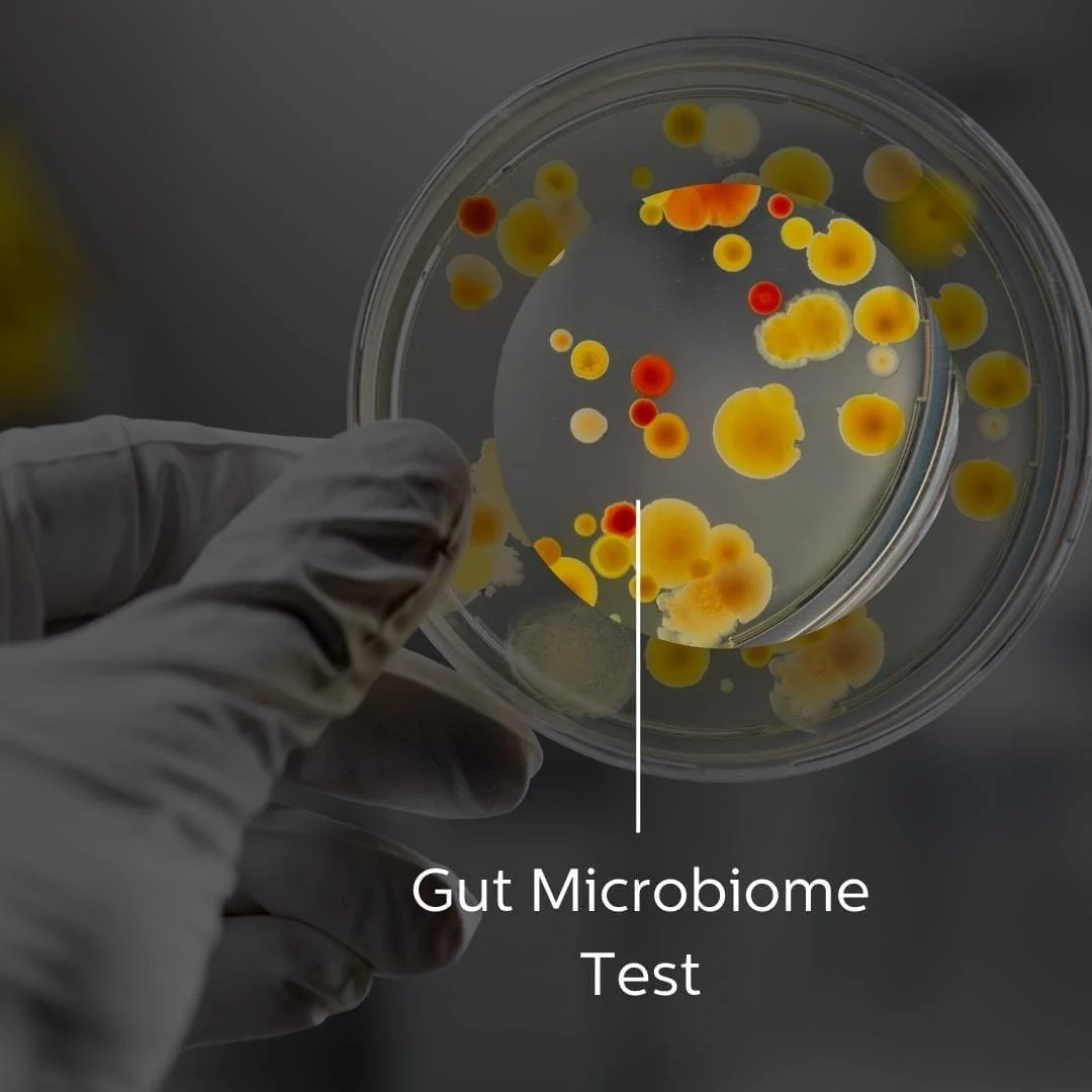 GutMicrobiomeTest