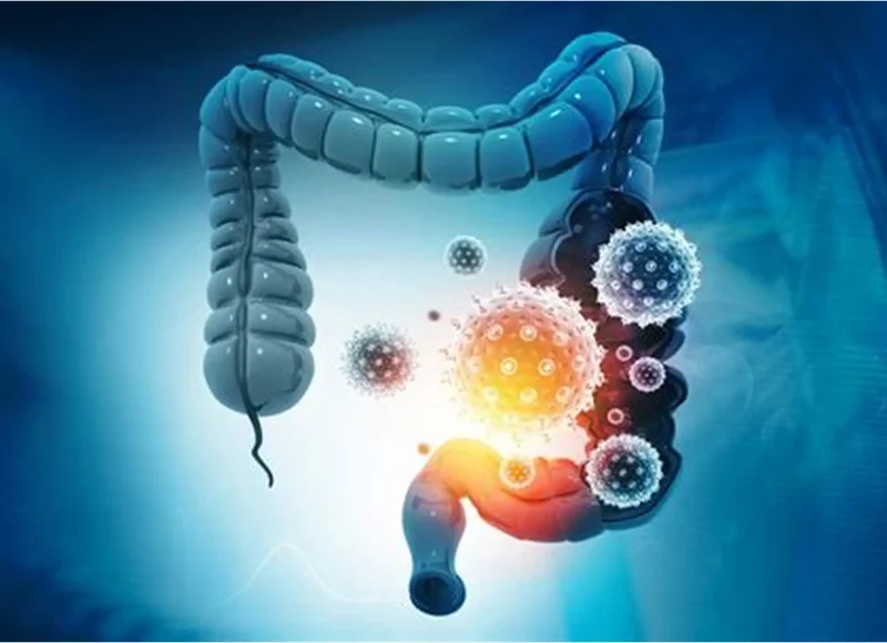 Gutbackteriascreening